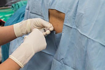 Epidural
